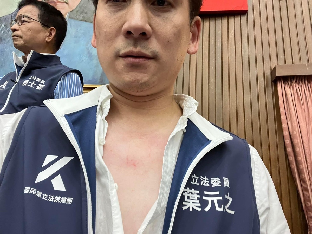 立法院朝野立委激烈衝突下，有多人受傷。圖為國民黨立委葉元之。 圖：葉元之/提供