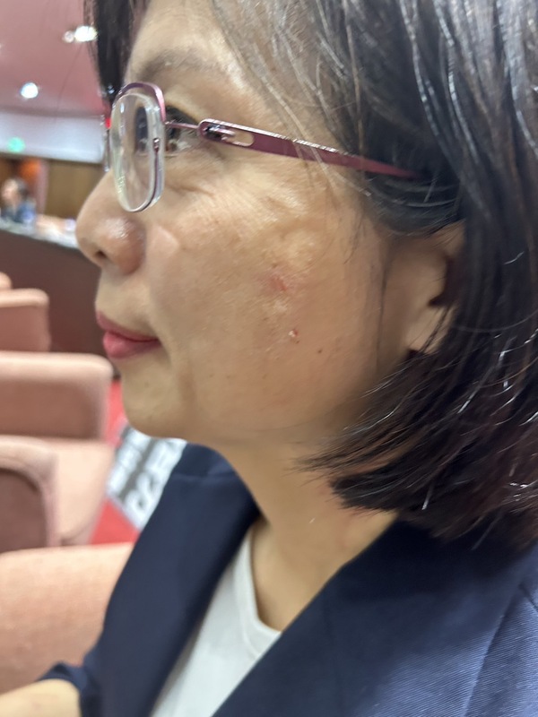 民進黨立委林淑芬控訴遭藍委馬文君抓傷。 圖：立法委員黃捷辦公室/提供