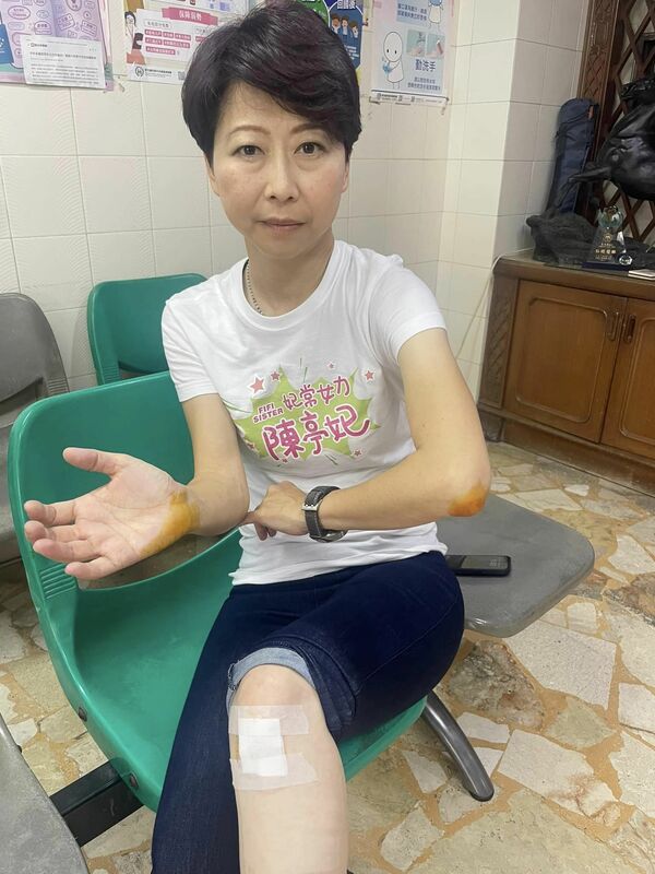 陳亭妃指控，在衝突中被國民黨立委徐巧芯拉住衣領，因而跌倒導致左膝流血。 圖 : 翻攝自陳亭妃臉書