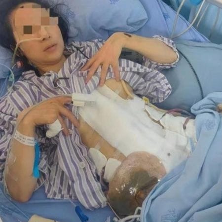 小謝被賀姓丈夫打到腎、肝、肺等內臟均受損傷，十二指腸也被污染，無法排便，必須終身掛著糞袋。 圖：翻攝微博