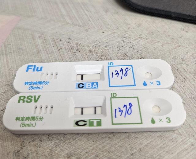 林智葳在診所篩出病患得了RSV。圖中上流感快篩劑A型B型流感為陰性，C則為控制線。 圖：翻攝自醫心葳你Wei醫師～林智葳醫師  臉書專頁