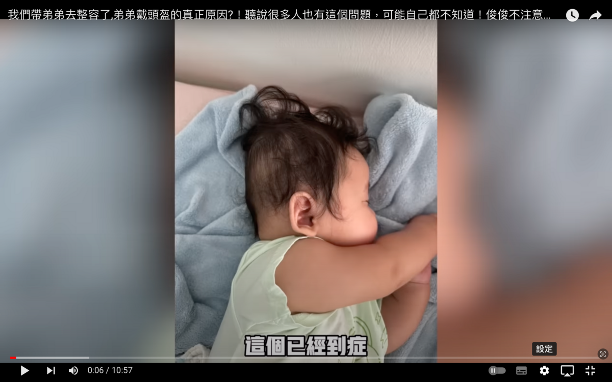 Jeff＆Inthira日前透露目前8個月大的小兒子罹患扁頭症，醫生建議戴定制頭盔接受頭型矯正。 圖：翻攝自Jeff＆Inthira YT頻道