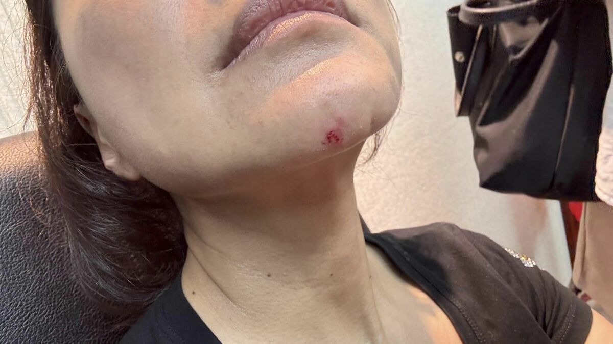 立院開場就流血！王鴻薇暴打林楚茵全都錄 網喊告到底