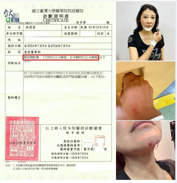 林楚茵（右上圖）po出的台大醫院診斷證明書（左圖），上面寫明：「臉部鈍挫傷，下巴約0.5公分擦傷，右手腕約0.3公分擦傷」。 圖：翻攝自林楚茵臉書