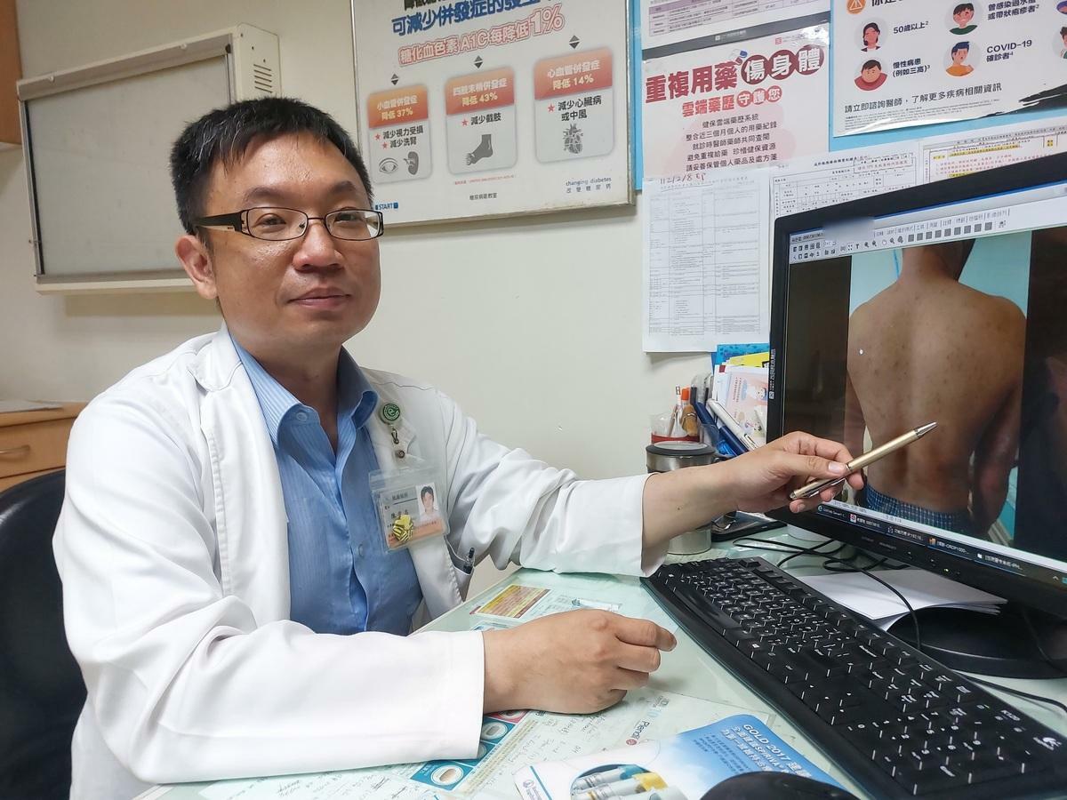 光田綜合醫院感染科陳俊志醫師表示近期水痘有增加趨勢，提醒民眾留意。 圖：光田綜合醫院/提供