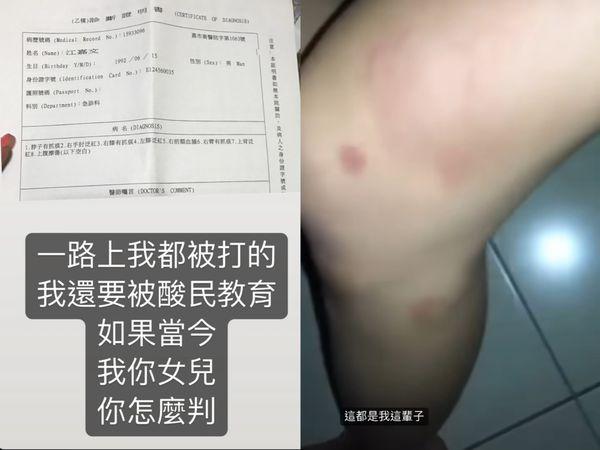 罔腰PO出醫院的診斷證明書。 圖：翻攝自罔腰IG