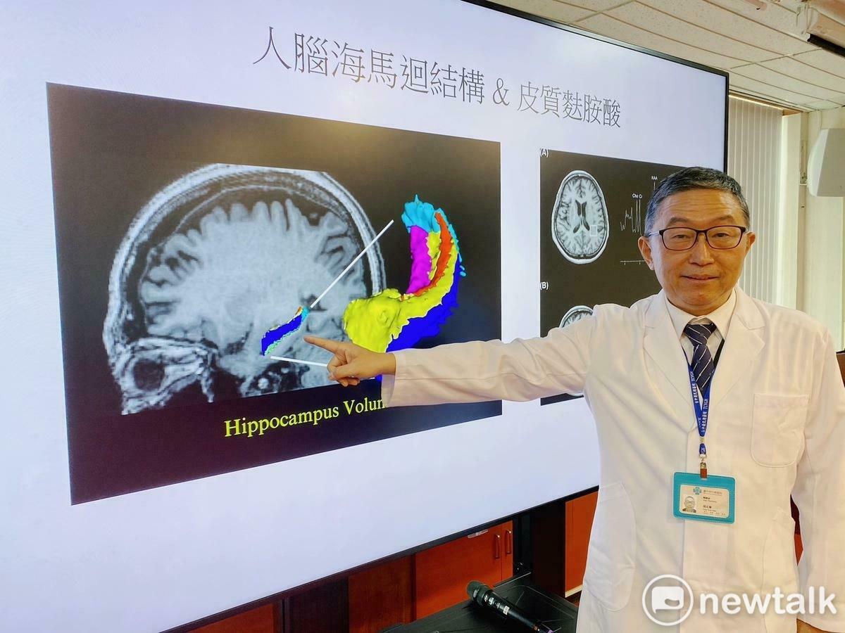 周元華醫師詳細講解在大腦中判定思覺失調症狀的關鍵及技術精髓所在。 圖：實習記者張博森/攝