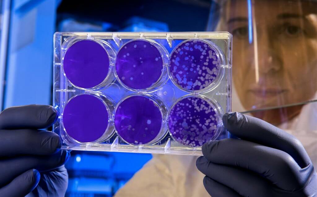 研究：超級細菌未來25年內恐致3900萬人死亡
