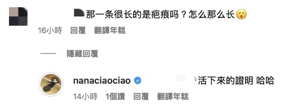網友好奇詢問「那一條很長的是疤痕嗎？怎麼那麼長？」。對此，阿圓回答「活下來的證明，哈哈」。 圖：翻攝自一隻阿圓IG