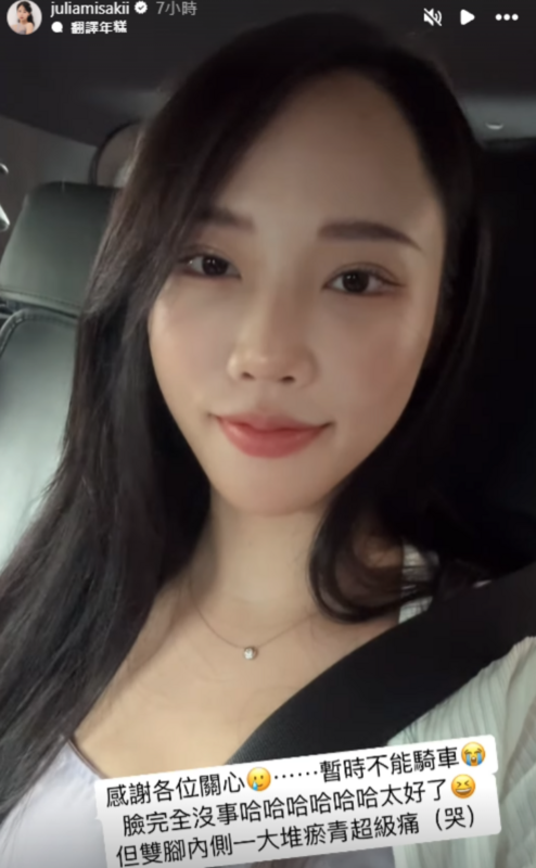 消息傳出後引發外界擔心，而咪妃也在社群平台跟粉絲報平安「暫時不能騎車，臉完全沒事太好了」。 圖：翻攝自咪妃IG