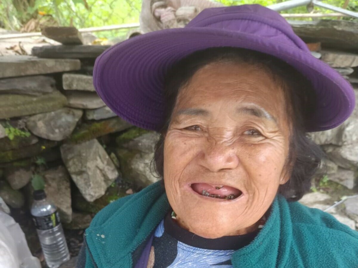 偏鄉缺少長期駐診醫師，老人多面臨牙齒損壞或牙周炎等問題，無法及時獲得治療。 圖：范織欽服務處提供