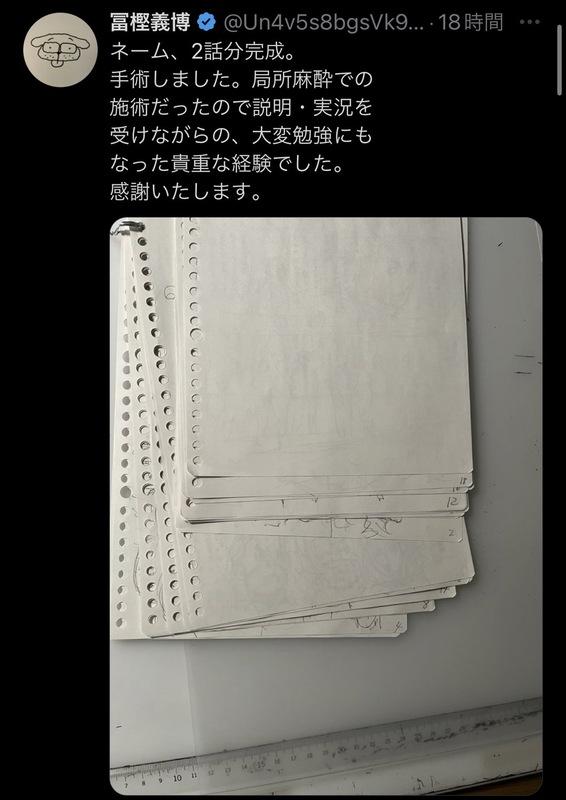 昨(28)日冨樫義博證實已入院動手術，且沒有因此停下漫畫進度，讓網友忍不住擔心他的身體狀況「老師要好好保重身體」。 圖：翻攝自冨樫義博X