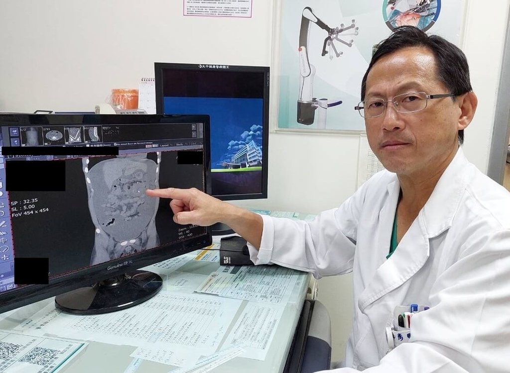 15歲少年罹大腸癌末期，苗栗大千綜合醫院外科部主任馮啟彥警示，癌症有年輕化趨勢。 圖：苗栗大千綜合醫院／提供