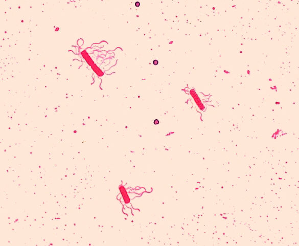 學名「Bacillus cereus」的蠟樣芽孢桿菌就是一般所說的「仙人掌桿菌」。 圖：翻攝維基百科/CDC PHIL/公有領域
