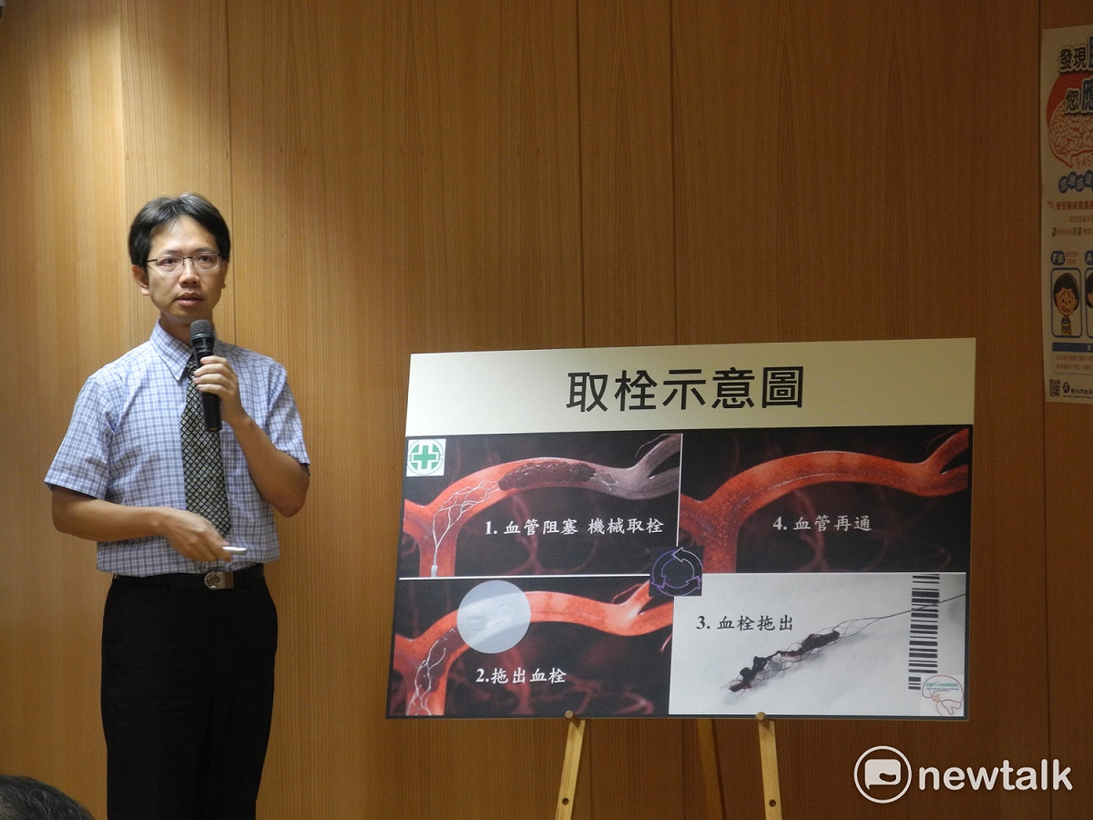 「腦中風緊急醫療處置照護網」2.0版導入「動脈取栓術」。 圖：王峻昌/攝