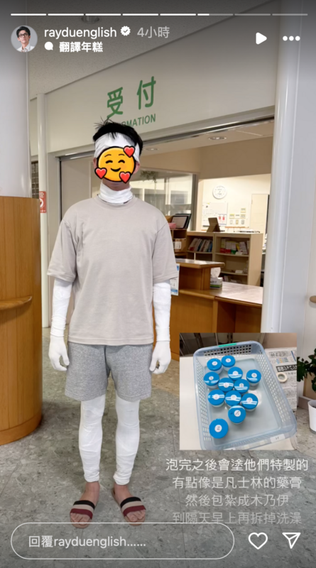 阿滴還曬出自已四肢、額頭、脖子都包裹著繃帶的照片，表示泡完後石頭浴後，要塗上院方特製的藥膏，「然後包紮成木乃伊，到隔天早上再拆掉洗澡」。 圖：翻攝自阿滴英文IG
