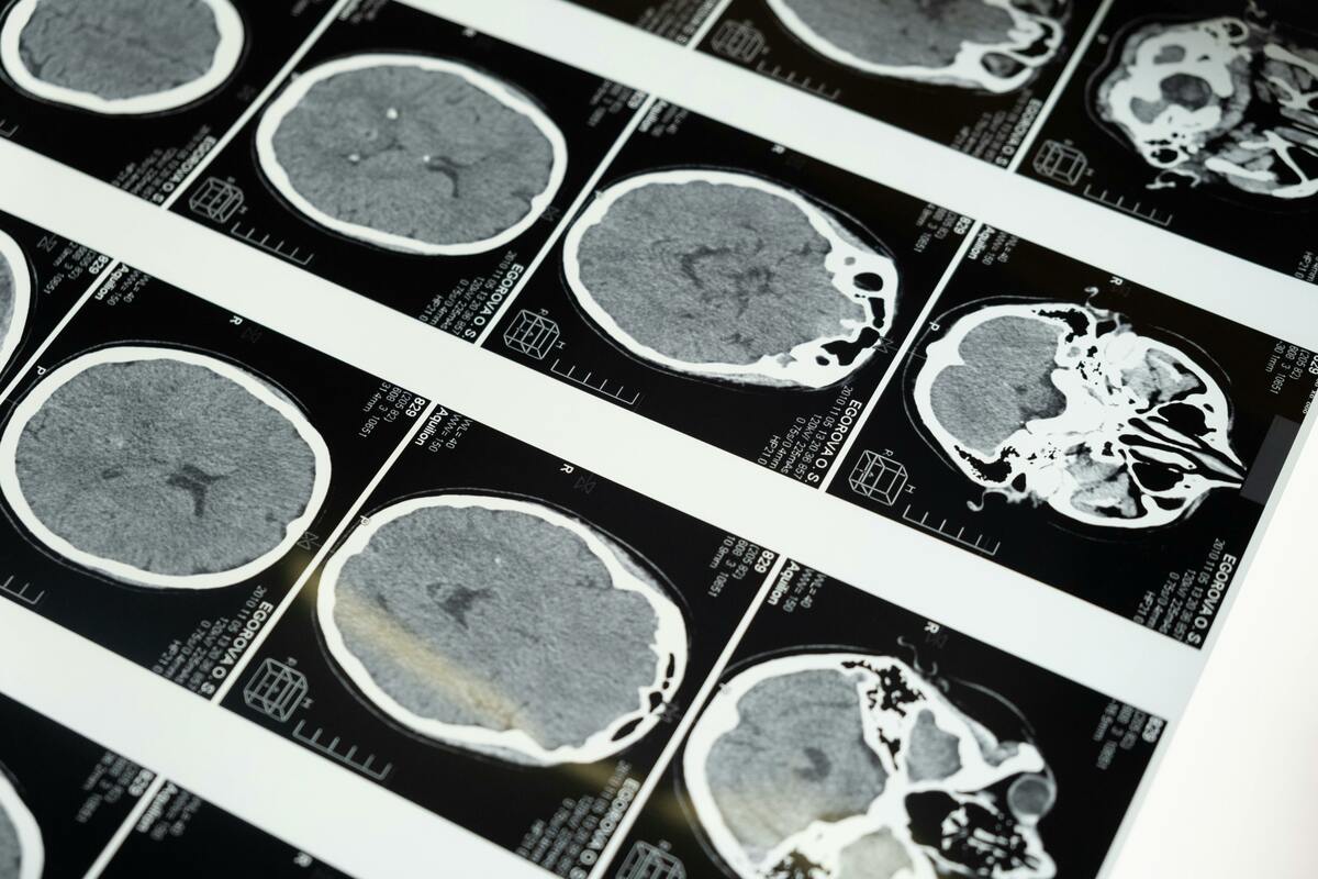 這項科學成果由美國艾倫腦科學研究所（Allen Institute for Brain Science）聯手貝勒醫學院（Baylor College of Medicine）及普林斯頓大學（Princeton University），動員 150 名科學家、歷時近十年完成，相關研究已於 4 月 9 日發表在《自然》（Nature）期刊。 圖 : 翻攝自 pexels