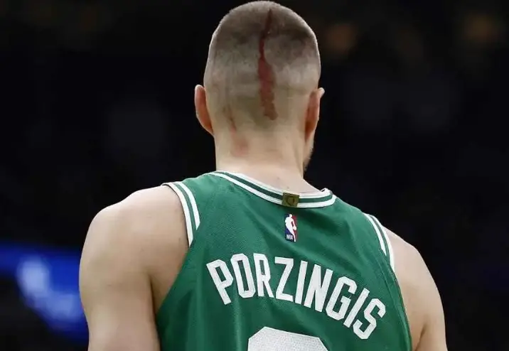 ▲Kristaps Porzingis遭到魔術中鋒Goga Bitadze肘擊頭部、血流滿面，仍堅持完成比賽。（圖／美聯社／達志影像）