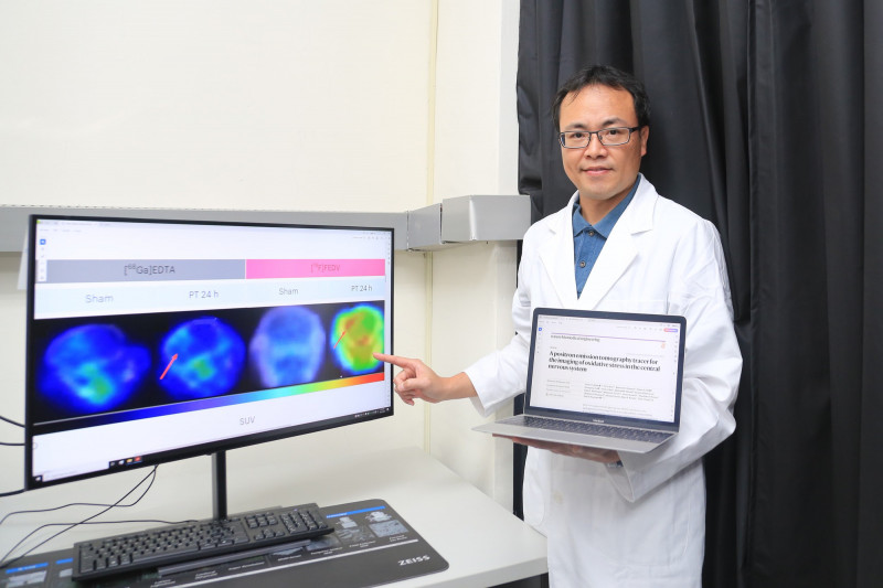 國立中山大學生技醫藥研究所助理教授孫羽佑今(28)日指出，與美跨國合作，開發非侵入式技術，可即時偵測腦部氧化壓力，助攻阿茲海默症、中風與漸凍人疾病早期診斷。 圖：中山大學／ 提供