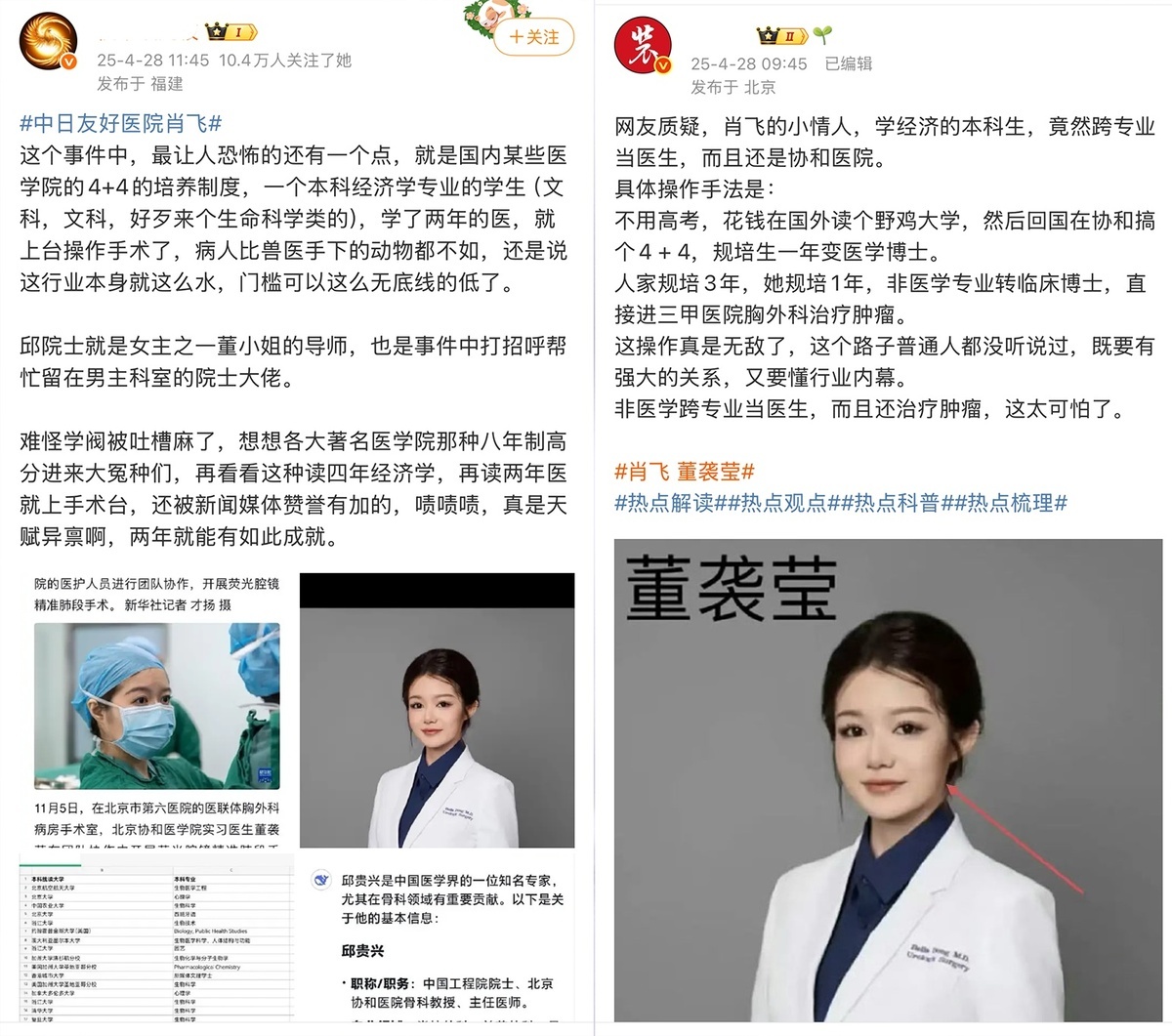 董襲瑩的背景更為此事件增添話題性。她本科畢業於美國哥倫比亞大學巴納德女子學院，主修經濟學，返國後參與北京協和醫學院「4+4臨床醫學試點班」計畫。該計畫允許非醫學本科生經 4 年學習後取得臨床醫學博士，並進入規培體系。 圖:翻攝自X帳號@whyyoutouzhele