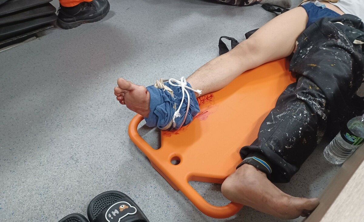 印尼漁工作業時不慎被鋼索弄傷右腳。 圖：海巡署艦隊分署/提供