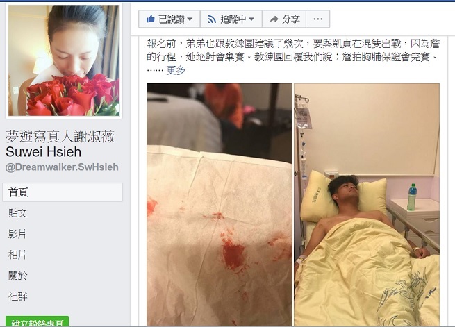 詹詠然與謝淑薇，為了世大運混雙賽又槓上。謝淑薇在臉書貼出弟弟掛病號照片。 圖:陳香蘭／翻拍謝淑薇臉書