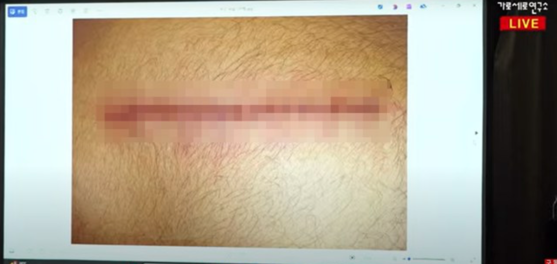 這名提供音檔的友人聲稱因為捲入此事，遭到不明人士襲擊。 圖：翻攝自橫豎研究所YT頻道