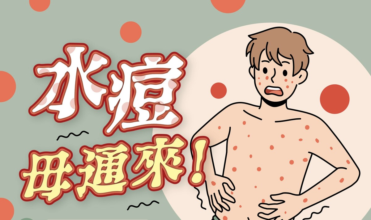 勤洗手及注意咳嗽禮節，避免水痘上身。 圖：高雄市衛生局/提供