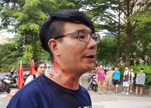 「中國新歌聲」主辦單位宣布活動暫停後，台大後門傳出有黑衣人持甩棍打傷台大學生，被打學生當場頭破血流。 圖：翻攝田昀凡臉書
