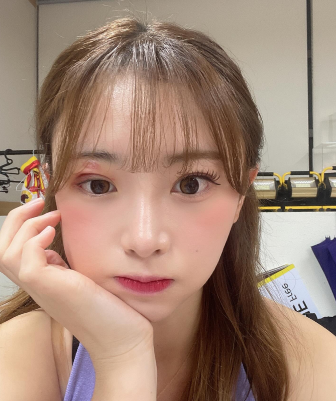 金娜妍罹患了俗稱「皮蛇」的帶狀皰疹，而且還長在眼睛周圍，醫生表示可能會在臉上留下永久性的疤痕。 圖：翻攝自金娜妍Threads