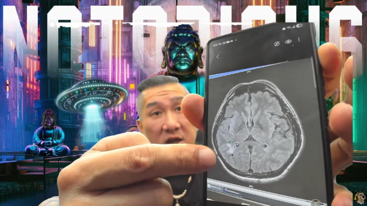館長陳之漢自曝健檢發現腦血管萎縮與白色陰影，將於返台後接受 MRI 檢查。 圖：翻攝自館長惡名昭彰YouTube