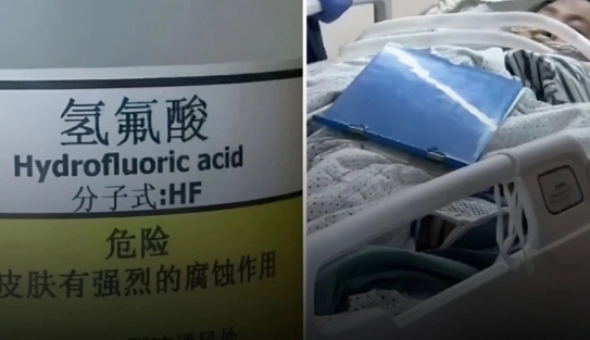 中國杭州市餘杭區一名 52 歲的余姓婦女，在經過閑林中路空地時，不慎腳踩到俗稱「化骨水」的氫氟酸中毒，經送醫急救後，不幸於 14 日晚間死亡。 圖 : 翻攝自 「科普作者雲杉」