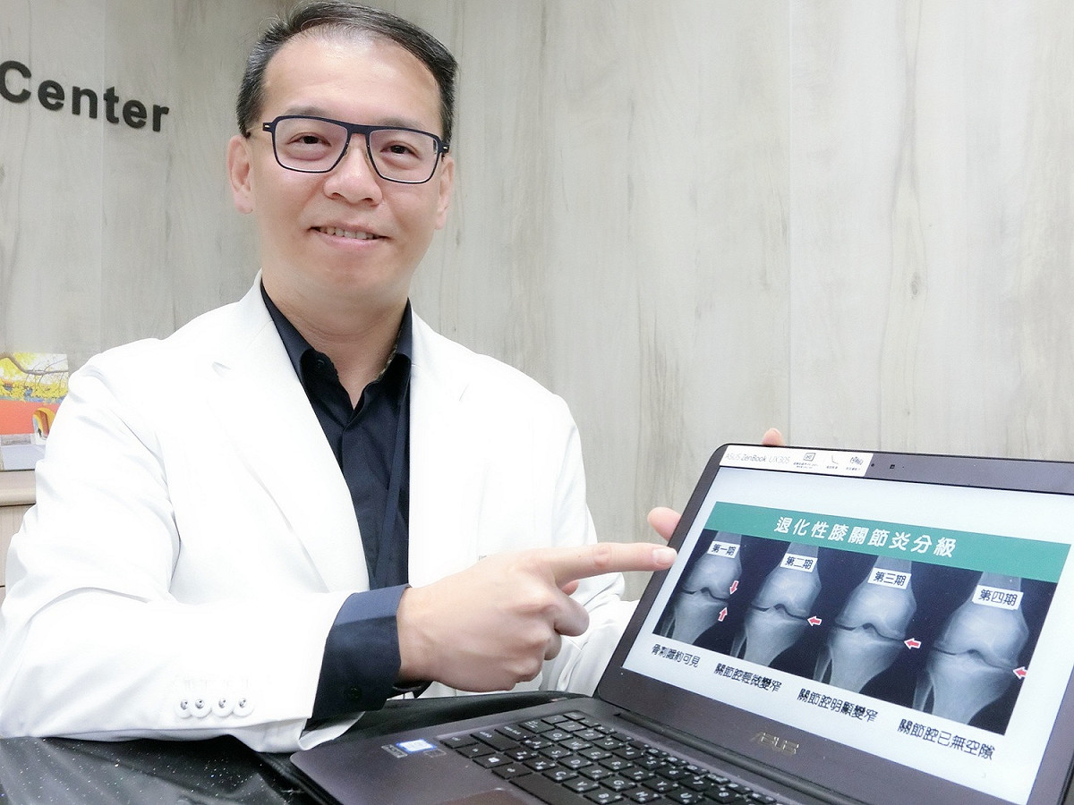 羅浩儒主任說明，骨關節炎症狀分為四期，第一期還可以靠復健運動保持不惡化，但第二期以後就需要透過吃藥，甚至打針、手術才可能不再疼痛。圖：唐復年／攝