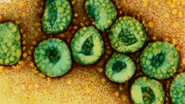 韓國衛生官員21日證實，1名76歲男子感染中東呼吸症候群（MERS），是韓國第3起確診案例。圖：翻攝網路