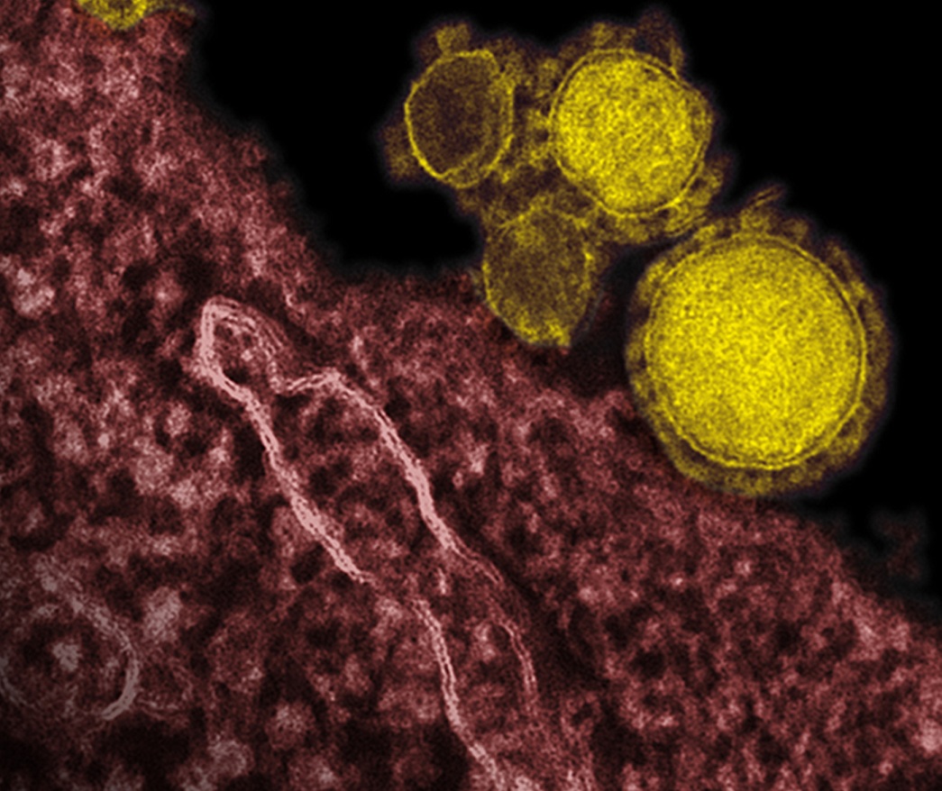 德國16日出現首名中東呼吸症候群冠狀病毒感染症（MERS-CoV）死亡病例。圖片來源：達志影像/美聯社。