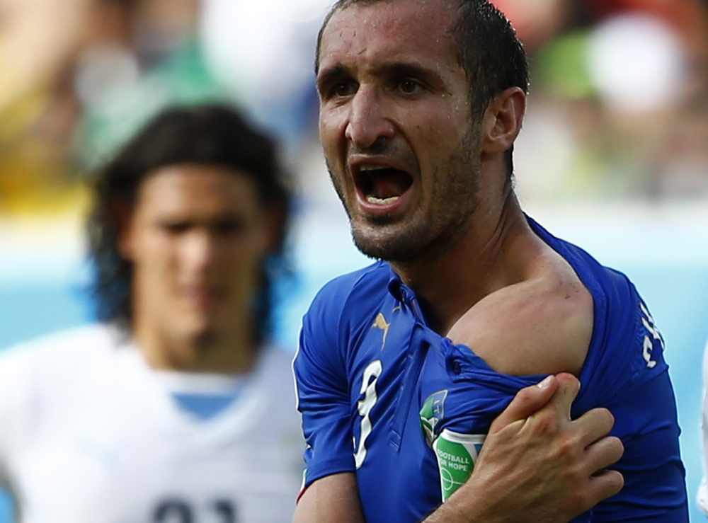被烏拉圭前鋒疑似咬傷的奇里尼（Giorgio Chiellini）氣憤地說：「蘇亞雷斯沒被判下場，真荒唐。」圖片來源：達志影像/路透社