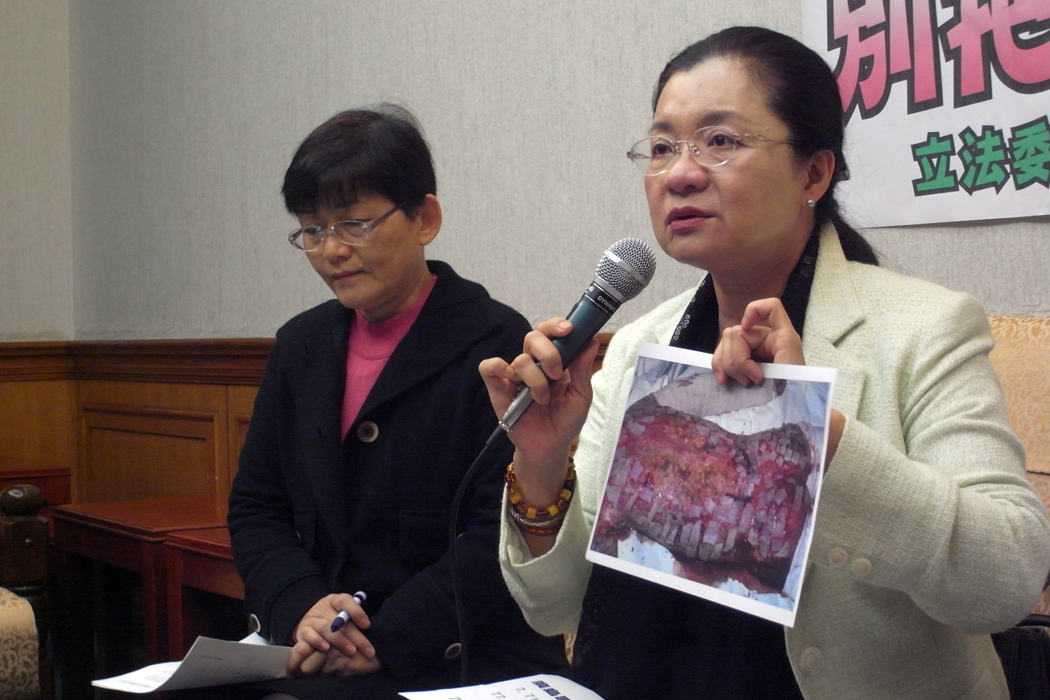 田秋堇今天上午召開記者會，回應蔡正元「核廢是寶」的說法，她拿出日本東海村核燃料再製廠發生意外被曝的工人受傷照片說，「這樣的東西還能說是無害的嗎？還能說是寶嗎？」圖：楊宗興/攝