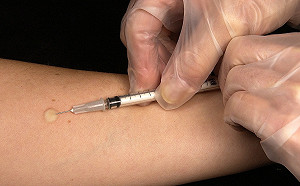 水痘不是兒童專利！衛福部：成人感染更嚴重