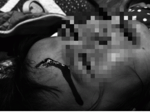 護師工會看綠島醫事件：用醫德去綁架醫師公平嗎？