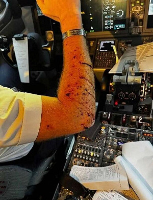 美聯航客機遭不明物體擊中! 擋風玻璃碎裂 飛行員負傷緊急迫降