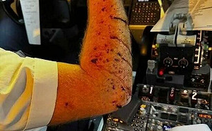 美聯航客機遭不明物體擊中! 擋風玻璃碎裂 飛行員負傷緊急迫降