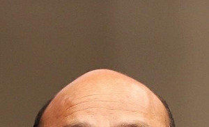 禿頭救星？台大團隊研發「20天生髮精華」登國際　1800萬外國網友關注：保護台灣