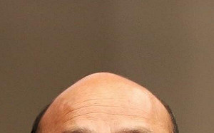 禿頭救星?台大團隊研發「20天生髮精華」登國際 1800萬外國網友關注:保護台灣