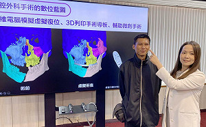 車禍後嚴重雙眼複視 台中榮總眼外肌移位手術 讓他看東西不再睜一眼閉一眼