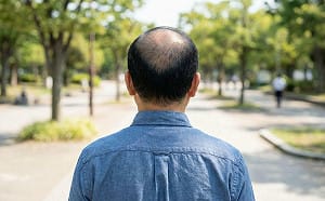 頂上無毛，國家來扛！南韓總統拋震撼彈：「禿頭」讓健保來救