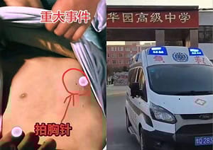 中國13歲生宿舍猝死校方竟偷運屍？左胸驚見「釘子大孔洞」真相引發網民怒火