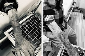 台中老翁行車糾紛遭毆 雙手皮開肉綻！打人者辯：沒打方向燈很危險