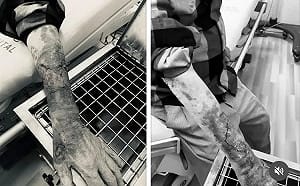 台中老翁行車糾紛遭毆 雙手皮開肉綻！打人者辯：沒打方向燈很危險