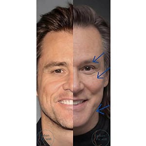 20年對比照瘋傳！金凱瑞被疑「換人」 醫曝真相：可能做過「這幾項」醫美