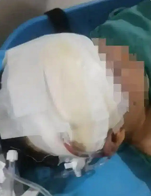 送去管教竟變送進ICU! 湖北13歲男童在「成長基地」被打到失明骨折